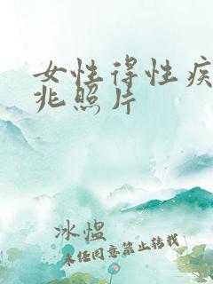 女性得性疾病前兆照片