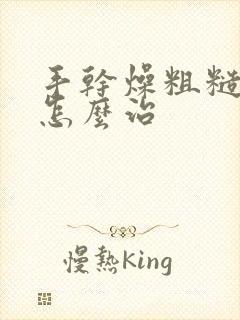 手干燥粗糙脱皮怎么治