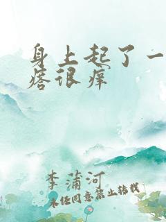 身上起了一片疙瘩很痒