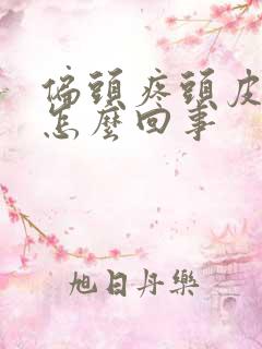 偏头疼头皮疼是怎么回事