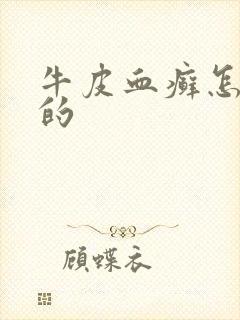 牛皮血癣怎么得的