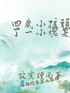 四岁小孩头发秃了一小块是什么原因