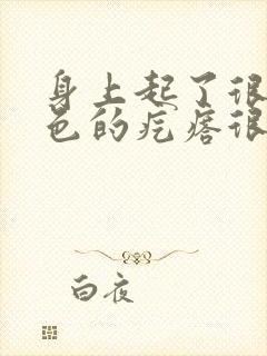 身上起了很多白色的疙瘩很痒