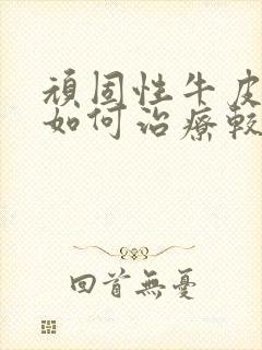 顽固性牛皮血癣如何治疗较好