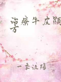 治疗牛皮显中药方