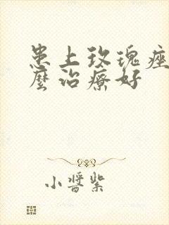 患上玫瑰痤疮怎么治疗好