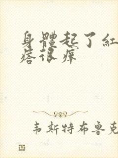 身体起了红色疙瘩很痒