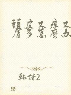 头皮又痒又头皮屑多怎么办