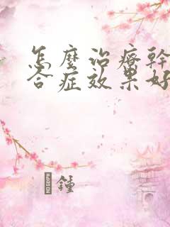 怎么治疗干燥综合症效果好