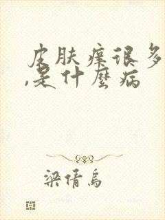 皮肤痒很多年了,是什么病