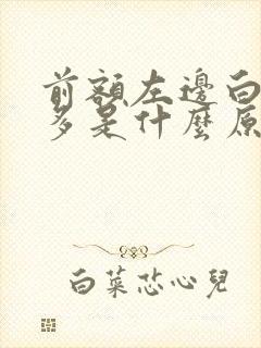 前额左边白头发多是什么原因