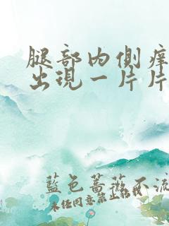 腿部内侧痒一挠出现一片片的疙瘩