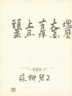 头上有大块头屑并且痒怎么治疗