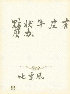 点状牛皮有癣怎么办