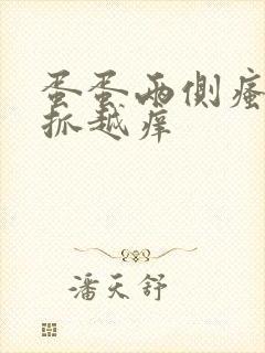 蛋蛋两侧瘙痒越抓越痒