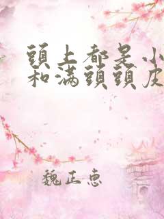 头上都是小疙瘩和满头头皮屑是怎么回事