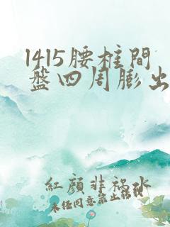 l4l5腰椎间盘四周膨出怎样治疗