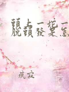 头上一坨一坨的脱头发是怎么回事