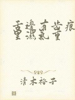 舌边有齿痕是哪里湿气重