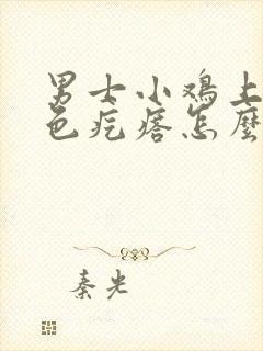 男士小鸡上起白色疙瘩怎么回事