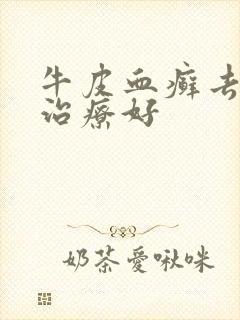 牛皮血癣去哪里治疗好