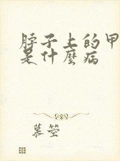 脖子上的甲状腺是什么病