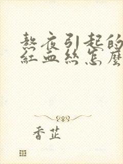 熬夜引起的眼睛红血丝怎么消除