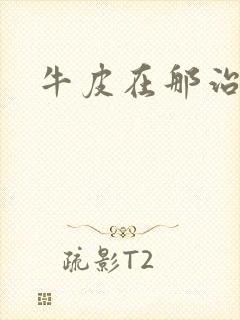 牛皮在那治疗好