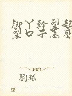 脚丫干裂起硬皮裂口子怎么办