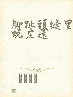 脚趾头缝里很痒蜕皮还