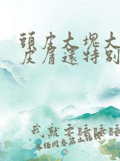 头皮大块大块头皮屑还特别痒怎么办