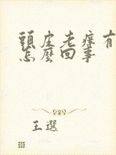 头皮老痒有头屑怎么回事