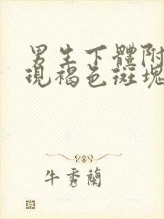 男生下体附近出现褐色斑块怎么回事