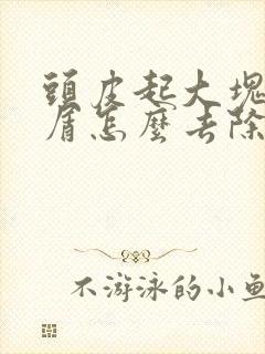 头皮起大块头皮屑怎么去除