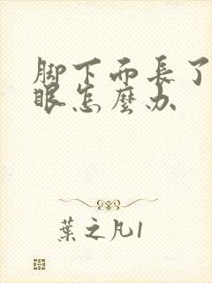 脚下面长了个鸡眼怎么办