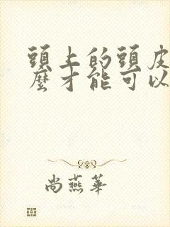 头上的头皮屑怎么才能可以去掉