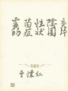 霉菌性阴炎图片的症状图片豆腐渣