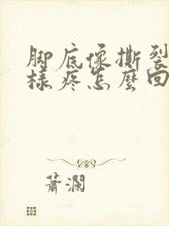 脚底像撕裂了一样疼怎么回事