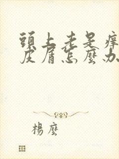 头上老是痒有头皮屑怎么办