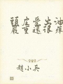 头皮爱出油掉发严重还很痒