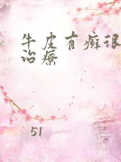 牛皮有癣很严重治疗