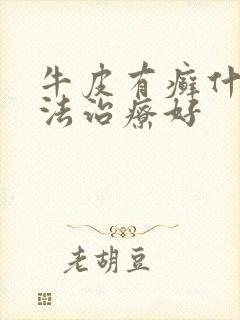 牛皮有癣什么方法治疗好