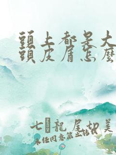 头上都是大块干头皮屑怎么治