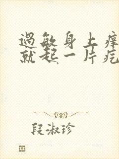 过敏身上痒一挠就起一片疙瘩