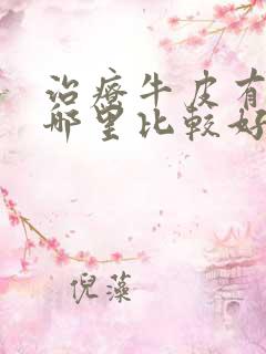 治疗牛皮有癣去哪里比较好