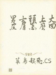 男士头上大片头皮屑怎么回事