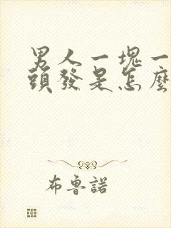 男人一块一块掉头发是怎么回事