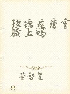 玫瑰痤疮会长在脸上吗