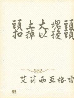 头上大块头皮屑扣掉以后头皮发红