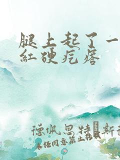 腿上起了一个大红硬疙瘩